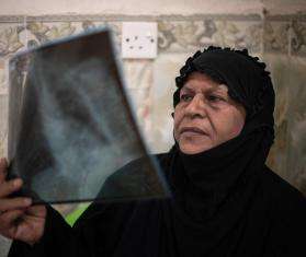 IRAQ: Tackling multidrug-resistant tuberculosis, one patient at a time