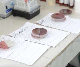 Three samples from 3 patients plated on culture media to identify bacteria in the CSREF laboratory in Koutiala, Mali.