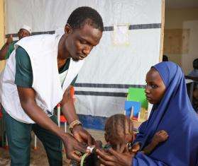 Overwhelming surge of malnutrition cases in Bauchi