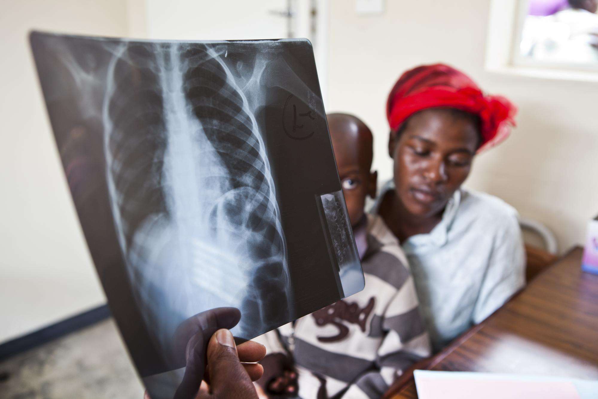 Primrose and her child Panashe as doctors confirm the seven-year-old boy is suffering from TB. 